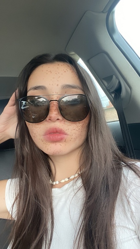 freckles sex galleries
