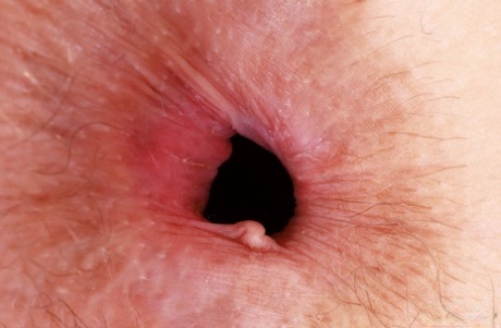 asshole close up beautiful naked galleries