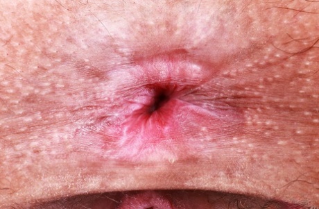 anus porn photos